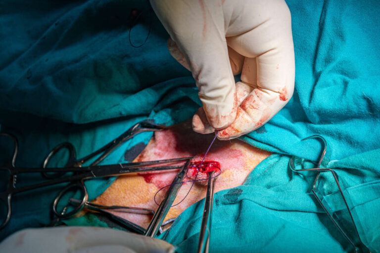 Surgeons closing a wound